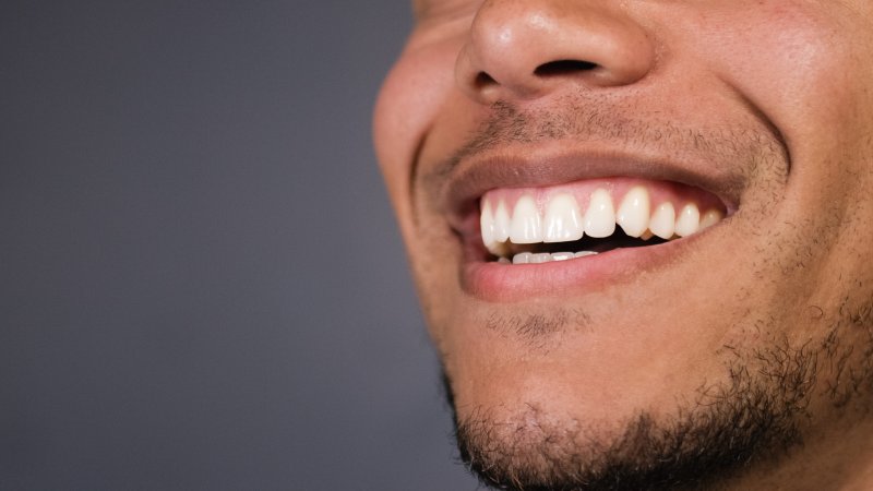 Invisalign NYC